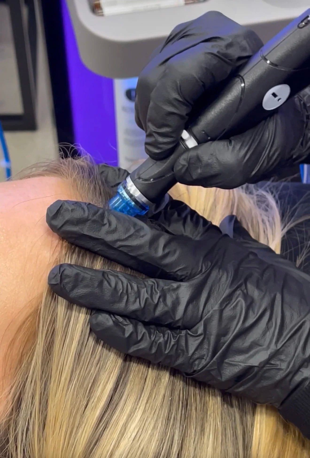 HydraScalp Keravive scalp treatment at Skin Study Med Spa in Plano, TX